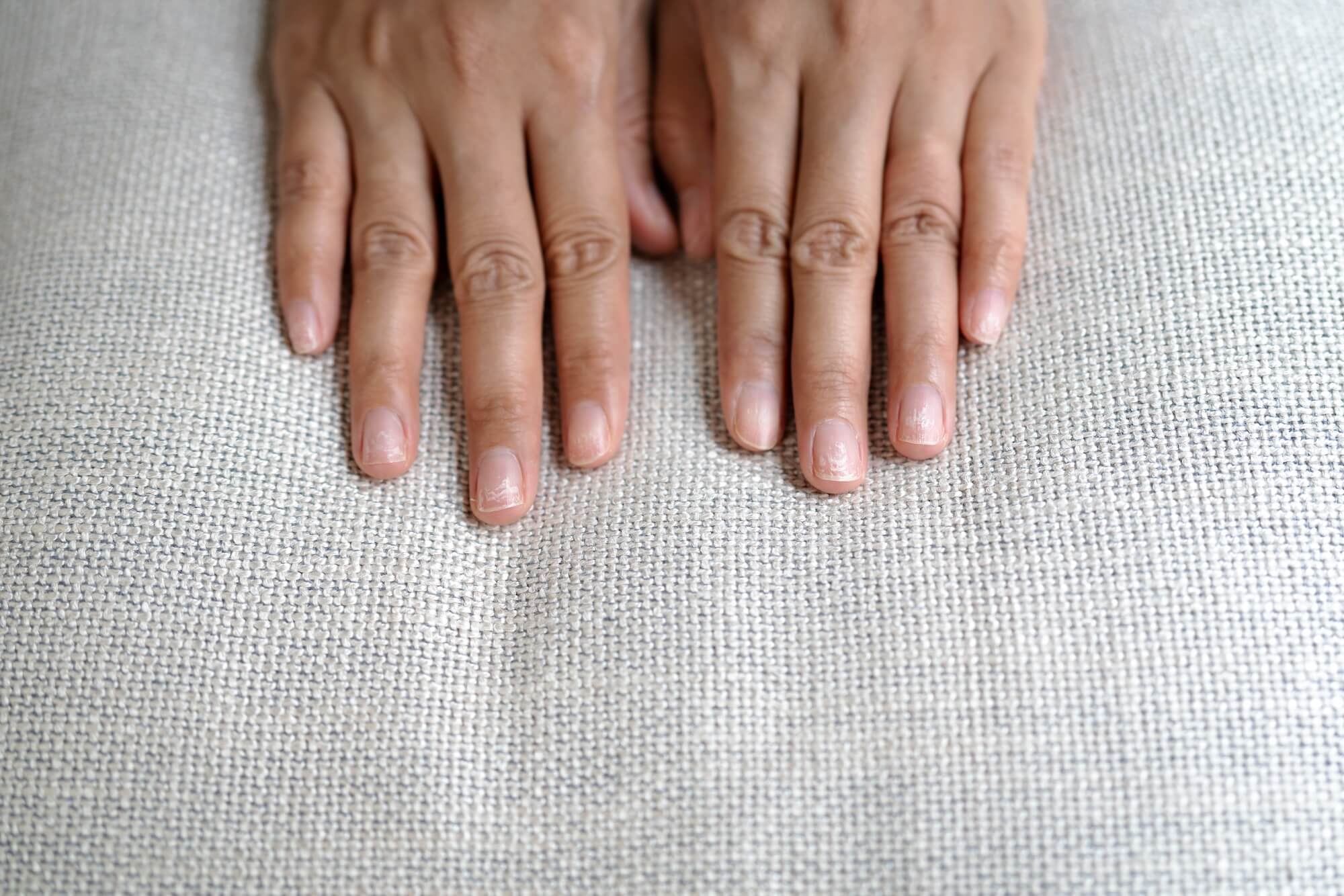 What Destroys Your Nails? 6 Everyday Habits That Make Them Weak, Brittle and Slow to Grow