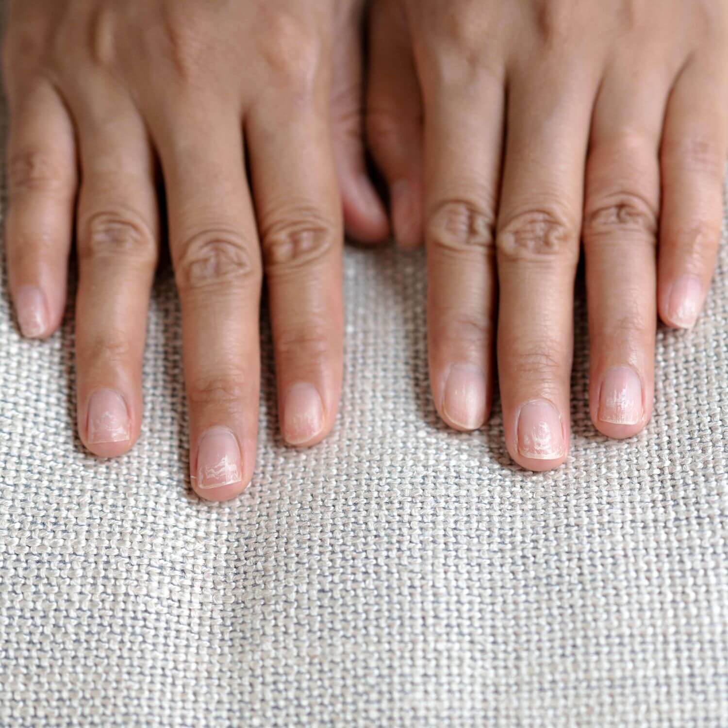 What Destroys Your Nails? 6 Everyday Habits That Make Them Weak, Brittle and Slow to Grow